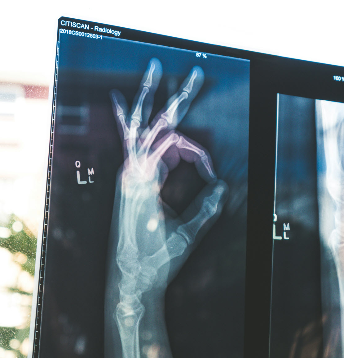 Understanding Preexisting Conditions with SakeOf