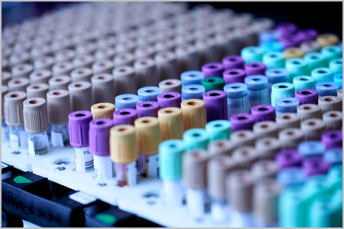 Organized blood samples ready for laboratory analysis